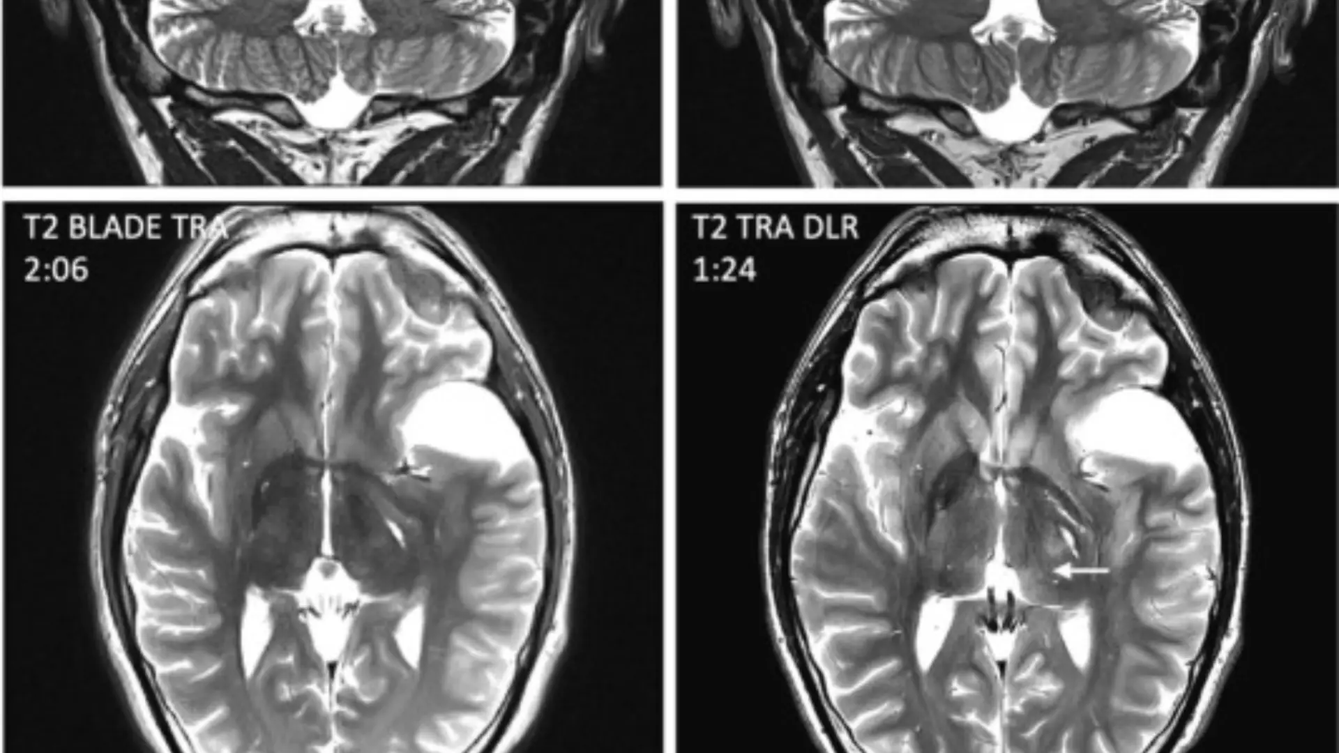 Deep learning permite sostener la productividad in con menos equipos de RM